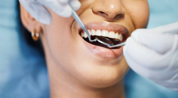 Best Emergency Root Canal Treatment in Los Angeles, CA